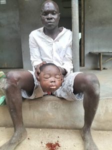 Read more about the article Man Nabbed With Fresh Human Head In Abeokuta