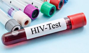 The UN Says Africa Off Course To HIV Goals