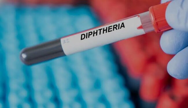 600 Nigerians So Far Died In Nationwide Diphtheria Outbreak