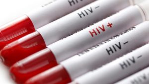 Over 46,000 Living with HIV/AIDS in Ogun, 12,654 Undetected Across the State